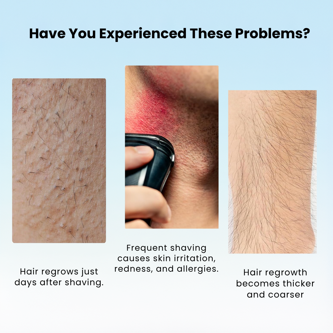 Smooth Skin Hair Removal