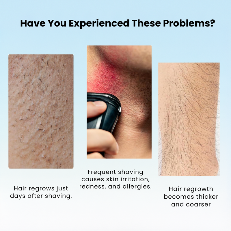 Smooth Skin Hair Removal